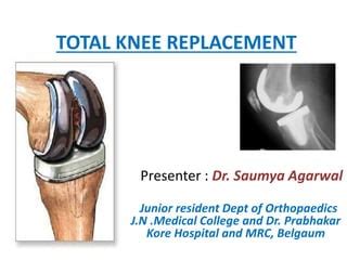 total knee replacement slideshare|Tkr by dr. saumya agarwal .